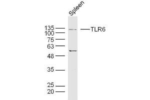 Rat spleen lysates probed with TLR6 Polyclonal Antibody, unconjugated  at 1:300 overnight at 4°C followed by a conjugated secondary antibody at 1:10000 for 90 minutes at 37°C.