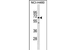 Western blot analysis in NCI-H460 cell line lysates (35ug/lane). (Selectin E/CD62e anticorps)