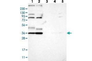Western blot analysis of Lane 1: RT-4, Lane 2: U-251 MG, Lane 3: Human Plasma, Lane 4: Liver, Lane 5: Tonsil with YIPF2 polyclonal antibody  at 1:250-1:500 dilution. (YIPF2 anticorps)