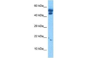 Host:  Rabbit  Target Name:  TCF21  Sample Tissue:  Human 293T Whole Cell  Antibody Dilution:  1ug/ml