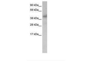 Image no. 1 for anti-Zinc Finger Protein 620 (ZNF620) (AA 361-410) antibody (ABIN203126) (ZNF620 anticorps  (AA 361-410))