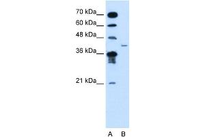 WB Suggested Anti-MFAP3L Antibody Titration:  2. (MFAP3L anticorps  (N-Term))