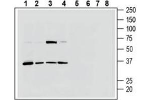 anti-Purinergic Receptor P2Y, G-Protein Coupled, 13 (P2RY13) (AA 266-281), (Extracellular) antibody