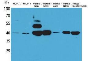 Western Blotting (WB) image for anti-Isocitrate Dehydrogenase 3 (NAD+) alpha (IDH3A) (Internal Region) antibody (ABIN3178348) (IDH3A anticorps  (Internal Region))