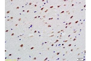 Formalin-fixed and paraffin embedded rat brain labeled with Anti-TUBB3 Polyclonal Antibody, Unconjugated  at 1:200 followed by conjugation to the secondary antibody and DAB staining (TUBB3 anticorps  (AA 401-450))
