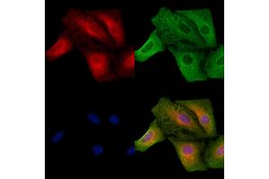ABIN6257242 and ABIN6273630 staining  cells by IF/ICC. (GRIP1 anticorps  (Internal Region))