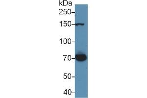Detection of THBS1 in Rat Serum using Polyclonal Antibody to Thrombospondin 1 (THBS1)