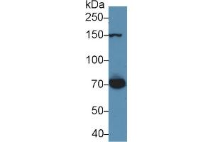 Detection of THBS1 in Rat Serum using Polyclonal Antibody to Thrombospondin 1 (THBS1) (Thrombospondin 1 anticorps  (AA 71-259))