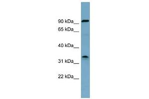 SDS antibody used at 1 ug/ml to detect target protein. (serine Dehydratase anticorps  (Middle Region))