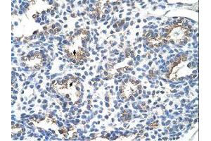 anti-Carcinoembryonic Antigen-Related Cell Adhesion Molecule 6 (CEACAM6) (AA 216-265) antibody