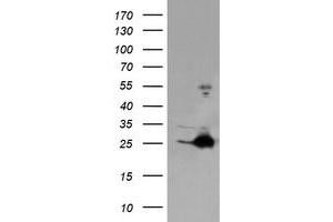 Image no. 1 for anti-Fetal and Adult Testis Expressed 1 (FATE1) antibody (ABIN1498221) (FATE1 anticorps)
