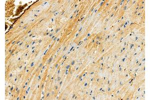 ABIN6265849 and ABIN6276500 at 1/100 staining Mouse heart tissue by IHC-P.