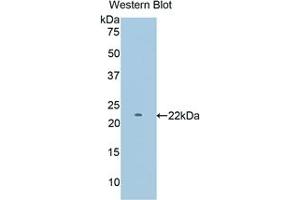 Detection of Recombinant PYGM, Mouse using Polyclonal Antibody to Glycogen Phosphorylase, Muscle (PYGM)
