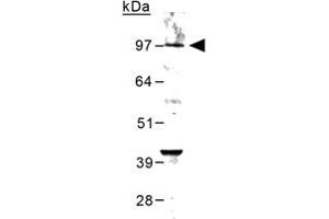Western blot analysis of Grm6 in mouse brain lysate using Grm6 polyclonal antibody  at 0.