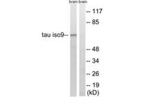 Western blot analysis of extracts from rat brain cells, using Tau (Ab-534/217) Antibody. (tau anticorps  (AA 181-230))