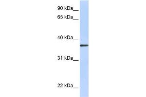 WB Suggested Anti-TTMB Antibody Titration:  0. (TMEM200B anticorps  (N-Term))