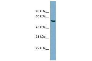 HHAT antibody used at 1 ug/ml to detect target protein. (HHAT anticorps  (N-Term))