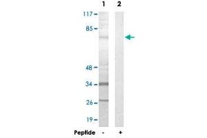 Western blot analysis of extracts from HepG2 cells, using FASTKD3 polyclonal antibody . (FASTKD3 anticorps)