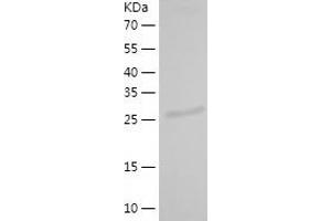 Western Blotting (WB) image for Ribonuclease P/MRP 30kDa Subunit (RPP30) (AA 1-268) protein (His-IF2DI Tag) (ABIN7124872)