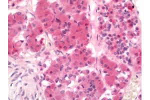 Human Pituitary: Formalin-Fixed, Paraffin-Embedded (FFPE)