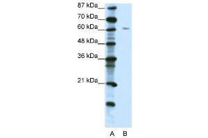 WB Suggested Anti-ZNF286  Antibody Titration: 1. (ZNF286A anticorps  (C-Term))