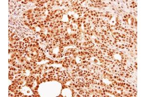 IHC-P Image Immunohistochemical analysis of paraffin-embedded NCI-N87 xenograft, using C9orf78, antibody at 1:500 dilution. (C9orf78 anticorps)