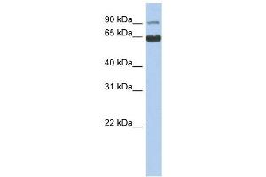 CCDC128 antibody used at 1 ug/ml to detect target protein. (KLRAQ1 anticorps  (N-Term))