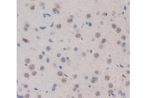 Used in DAB staining on fromalin fixed paraffin- embedded brain tissue (Exonuclease 1 anticorps  (AA 1-250))
