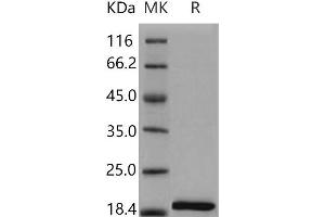 Western Blotting (WB) image for Interleukin 1, beta (IL1B) (Active) protein (ABIN7320465) (IL-1 beta Protéine)