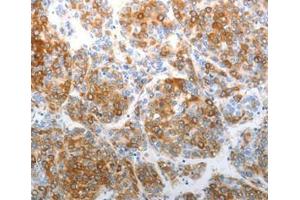 Immunohistochemical analysis of paraffin-embedded Human tonsil cancer tissue using at dilution 1/40. (CHD5 anticorps  (C-Term))