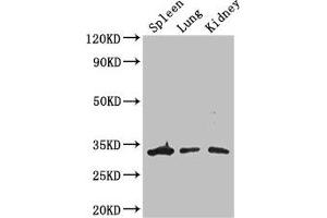 Western Blot Positive WB detected in: Mouse spleen tissue, Mouse lung tissue, Mouse kidney tissue All lanes: ALKBH4 antibody at 3 μg/mL Secondary Goat polyclonal to rabbit IgG at 1/50000 dilution Predicted band size: 34, 5 kDa Observed band size: 34 kDa