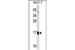 Western blot analysis in MCF-7 cell line lysates (35ug/lane). (ITGB1BP1 anticorps  (AA 108-136))