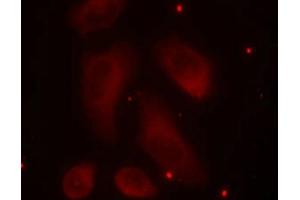 Immunofluorescence staining of methanol-fixed Hela cells using LIMK1(Phospho-Thr508) Antibody. (LIM Domain Kinase 1 anticorps  (pThr508))