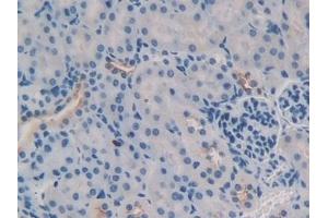 Detection of TNFSF9 in Mouse Kidney Tissue using Polyclonal Antibody to Tumor Necrosis Factor Ligand Superfamily, Member 9 (TNFSF9)