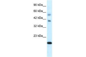 WB Suggested Anti-CGI-143 Antibody Titration:  0. (BOLA1 anticorps  (N-Term))