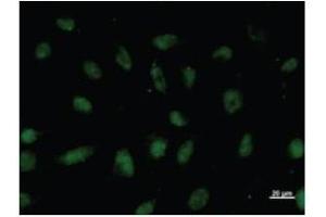 Immunostaining analysis in HeLa cells.