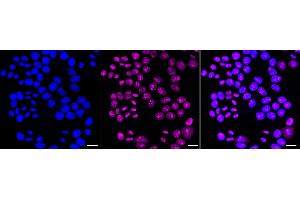 anti-Guanine Nucleotide Binding Protein-Like 3 (Nucleolar) (GNL3) antibody