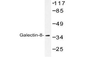 Western blot (WB) analysis of Galectin-8 antibody in extracts from 3T3 cells. (LGALS8 anticorps)