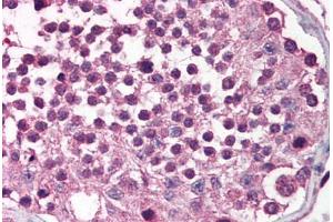 Human Testis (formalin-fixed, paraffin-embedded) stained with MADD antibody ABIN214509 at 2. (MADD anticorps  (C-Term))