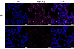 Immunocytochemical staining of HeLa cells using ARFGAP3 antibody (ABIN7797533), 1:1,000), Top panel: wild-type (WT), Bottom panal: ARFGAP3 shRNA knockdown (KD). (ARFGAP3 anticorps)