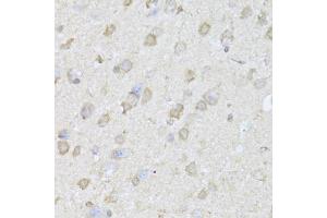 Immunohistochemistry of paraffin-embedded mouse brain using TRAP1 Antibody (ABIN1875197) at dilution of 1:100 (40x lens). (TRAP1 anticorps)