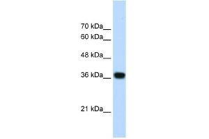 WB Suggested Anti-PSIP1 Antibody Titration:  1. (PSIP1 anticorps  (N-Term))