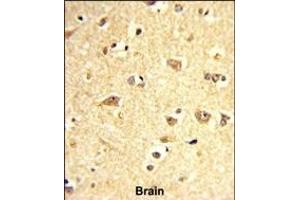 Formalin-fixed and paraffin-embedded human brain reacted with SOX4 Antibody (Center), which was peroxidase-conjugated to the secondary antibody, followed by DAB staining. (SOX4 anticorps  (AA 269-297))