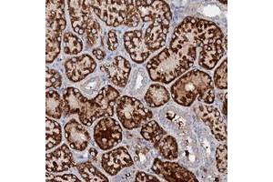 Immunohistochemical staining of human kidney with SLC10A7 polyclonal antibody  shows strong cytoplasmic positivity in cells in tubules at 1:50-1:200 dilution. (SLC10A7 anticorps)