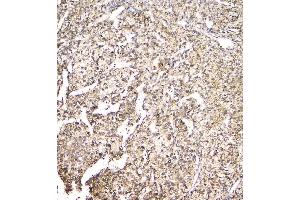 IHC analysis of EVA1A using anti-EVA1A antibody (ABIN6719564). (TMEM166 anticorps)