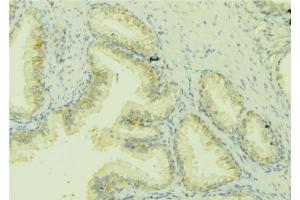 ABIN6279822 at 1/100 staining Mouse colon tissue by IHC-P. (CCL13 anticorps)