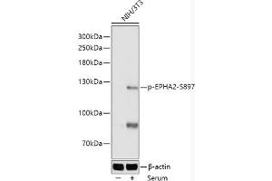 Western blot analysis of extracts of NIH/3T3 cells, using Phospho-EPH-S897 antibody (ABIN7266967) at 1:1000 dilution. (EPH Receptor A2 anticorps  (pSer897))