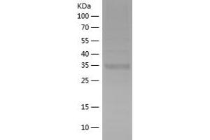 Western Blotting (WB) image for Hexokinase 3 (White Cell) (HK3) (AA 1-61) protein (His-IF2DI Tag) (ABIN7123325) (HK3 Protein (AA 1-61) (His-IF2DI Tag))