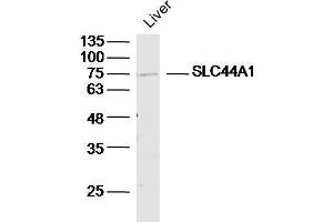 Mouse liver lysates probed with SLC44A1/CD92 Polyclonal Antibody, unconjugated  at 1:300 overnight at 4°C followed by a conjugated secondary antibody for 60 minutes at 37°C. (SLC44A1 anticorps  (AA 81-180))