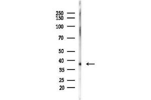 anti-X-Ray Repair Complementing Defective Repair in Chinese Hamster Cells 3 (XRCC3) (N-Term) antibody
